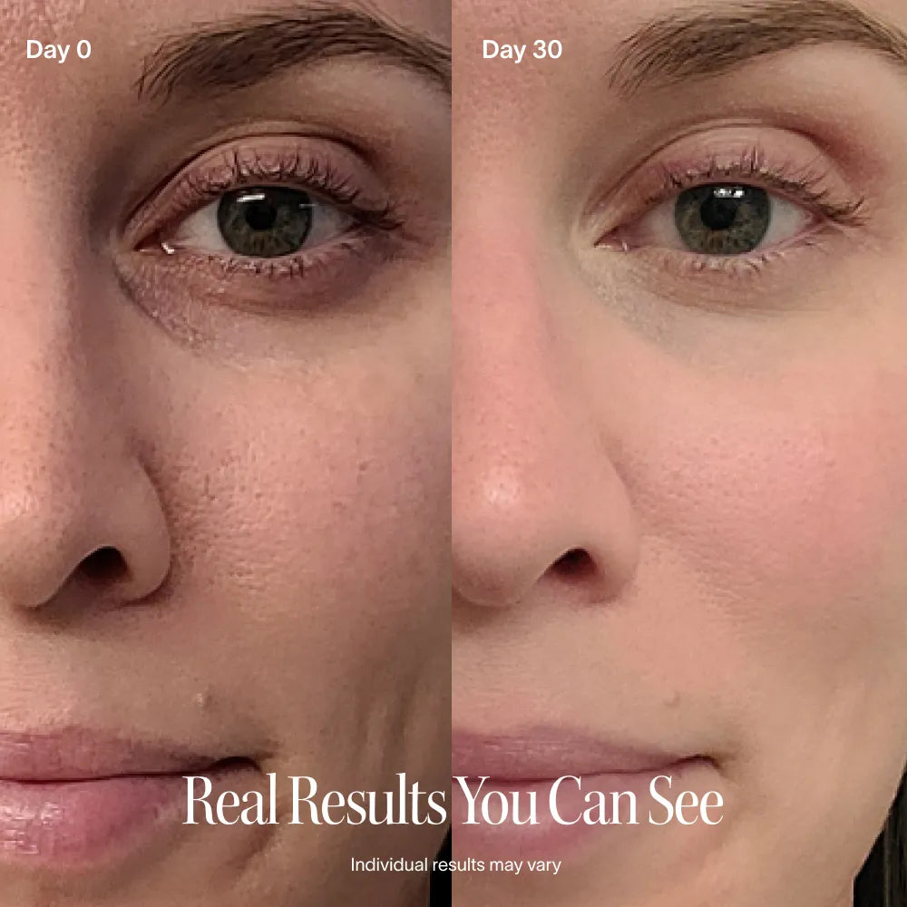 Close-up side-by-side of a womans face on Day 0 vs. Day 30 using the Solawave 4-in-1 Red Light Therapy Wand & Activating Serum Kit. Pores look reduced, skin texture smoother, and complexion improved. Text: Real Results You Can See. Results may vary.|| Rose Gold