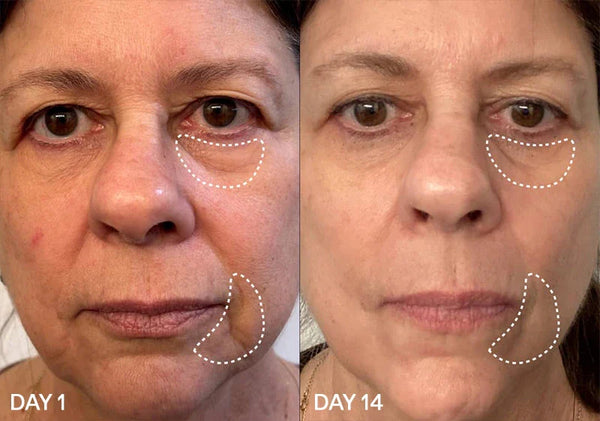 Before and after skincare results on a woman's face over 14 days, showing reduced wrinkles and fine lines.